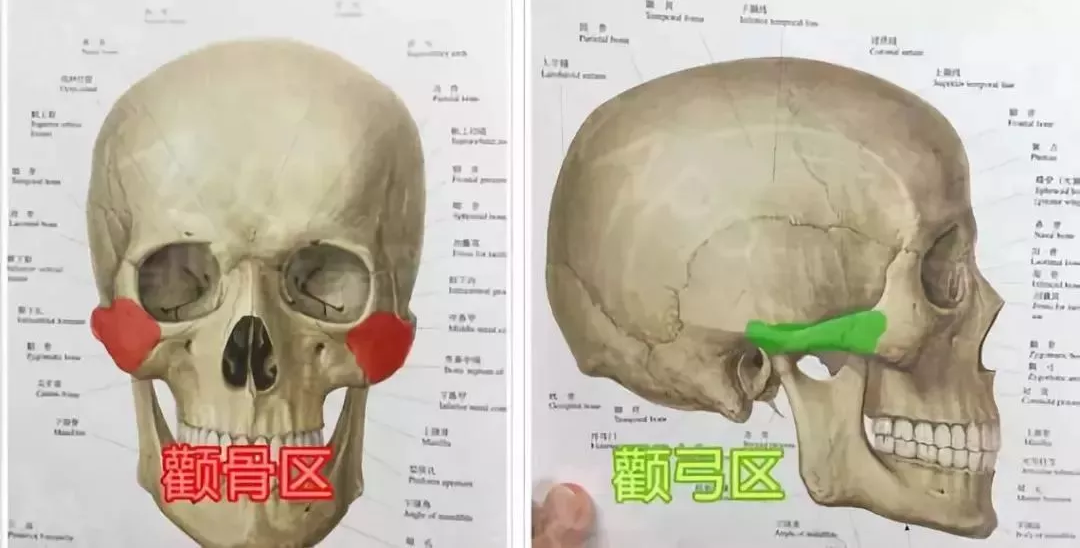 人体头骨颧骨区与颧弓区区别示意图